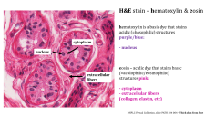 Gross Anatomy And Histology Of Normal Aorta Pathology