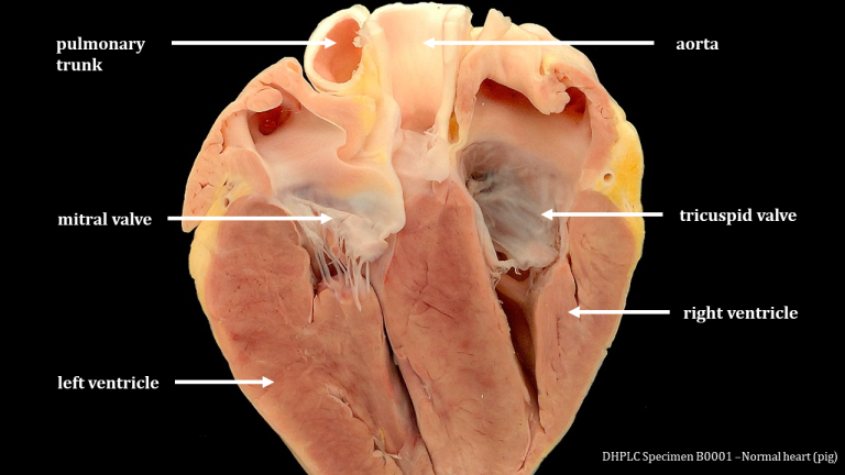 Gross Anatomy And Histology Of Normal Aorta Pathology