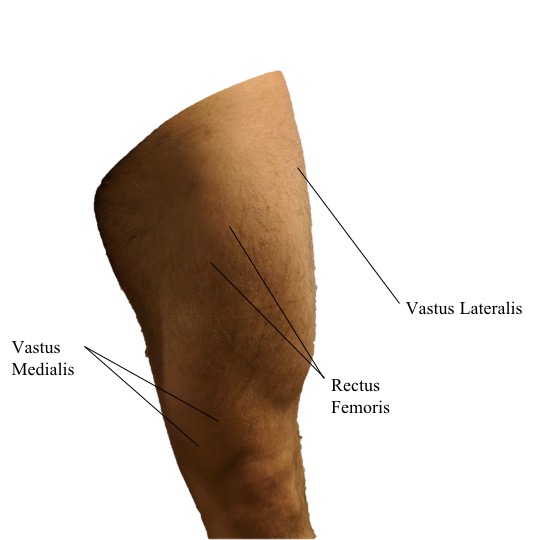 tibial tuberosity surface anatomy