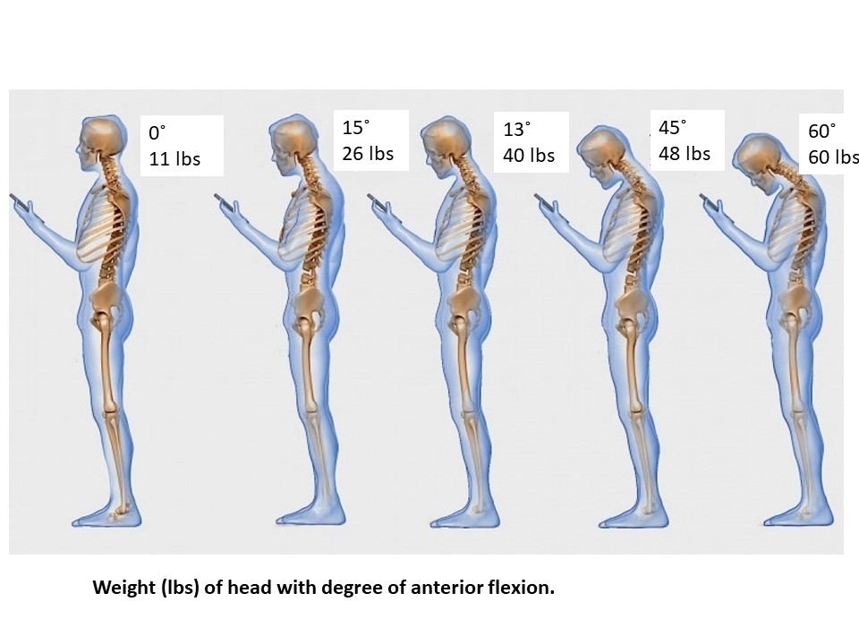 बहुत देर तक झुक कर मोबाइल फोन देखते रहना भी कायफोसिस (Kyphosis) का कारण हो सकता है