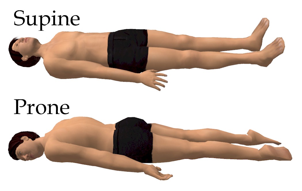 Supine Position Definition Medical Terms