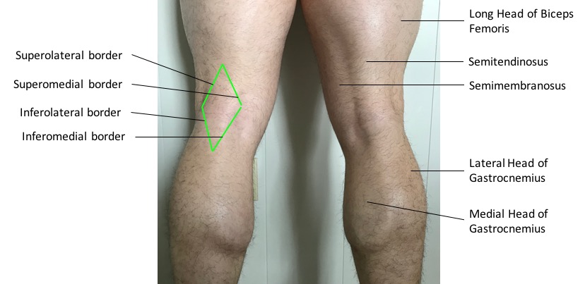 tibial tuberosity surface anatomy