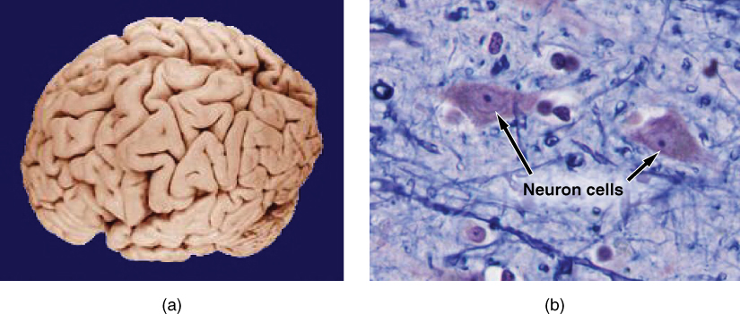 Photo A shows an entire human brain which has a lumpy and deeply striated appearance. Photo B is a micrograph of neural tissue. It contains two roughly diamond-shaped cells with dark nuclei. The cells are embedded in a light colored tissue containing smaller cells and fiber strands.