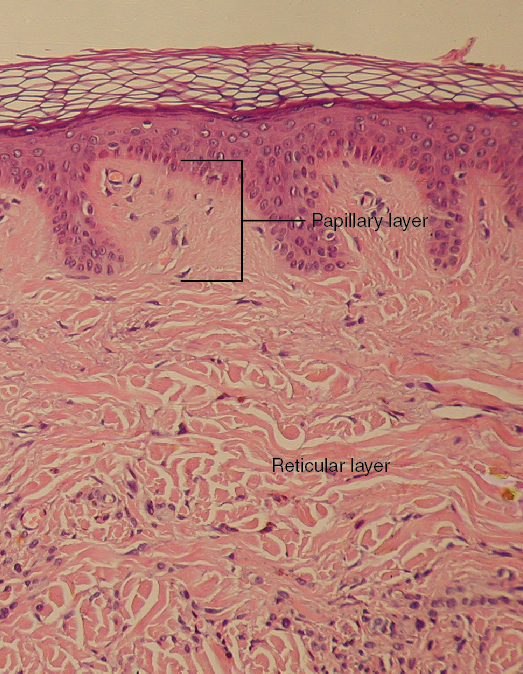 This micrograph shows layers of skin in a cross section. The papillary layer of the dermis extends between the downward fingers of the darkly stained epidermis. The papillary layer appears finer than the reticular layer, consisting of smaller, densely-packed fibers. The reticular layer is three times thicker than the papillary layer and contains larger, thicker fibers. The fibers seem more loosely packed than those of the papillary layer, with some separated by empty spaces. Both layers of the dermis contain cells with darkly stained nuclei.