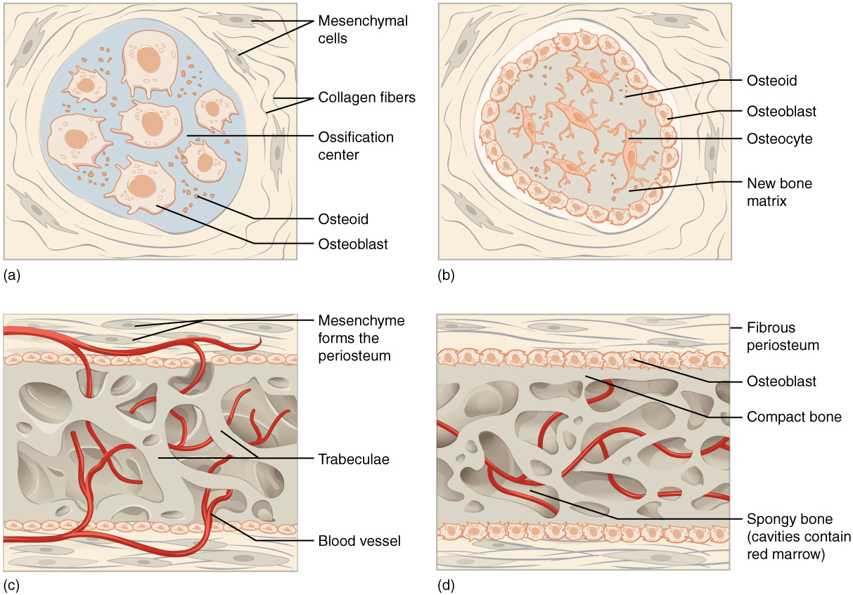 Image A shows seven osteoblasts, cells with small, finger like projections. They are surrounded by granules of osteoid. Both the cells and the osteoid are contained within a blue, circular, ossification center that is surrounded by a “socket” of dark, string-like collagen fibers and gray mesenchymal cells. The cells are generally amorphous, similar in appearance to an amoeba. In image B, the ossification center is no longer surrounded by a ring of osteoblasts. The osteoblasts have secreted bone into the ossification center, creating a new bone matrix. There are also five osteocytes embedded in the new bone matrix. The osteocytes are thin, oval-shaped cells with many fingerlike projections. Osteoid particles are still embedded in the bony matrix in image B. In image C, the ring of osteoblasts surrounding the ossification center has separated, forming an upper and lower layer of osteoblasts sandwiched between the two layers of mesenchyme cells. A label indicates that the mesenchyme cells and the surrounding collagen fibers form the periosteum. The osteoblasts secrete spongy bone into the space between the two osteoblast rows. Therefore, the accumulating spongy bone pushes the upper and lower rows of osteoblasts away from each other. In this image, most of the spongy bone has been secreted by the osteoblasts, as the trabeculae are visible. In addition, an artery has already broken through the periosteum and invaded the spongy bone. Image D looks similar to image C, except that the rows of osteoblasts are now secreting layers of compact bone between the spongy bone and the periosteum. The artery has now branched and spread throughout the spongy bone. A label indicates that the cavities between the trabeculae now contain red bone marrow.