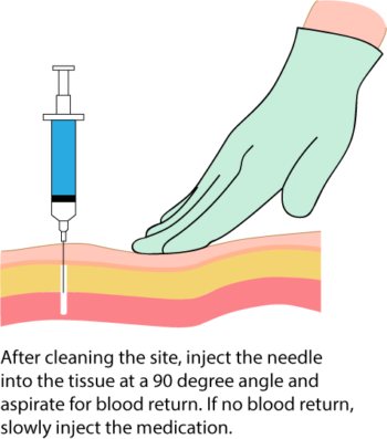 7.5 Intramuscular Injections – Clinical Procedures for Safer Patient Care