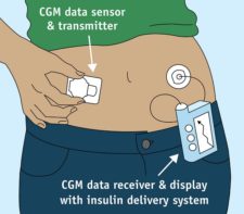 7.4 Subcutaneous Injections – Clinical Procedures for Safer Patient Care