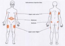 subcutaneous-injection-sites-002-225x157