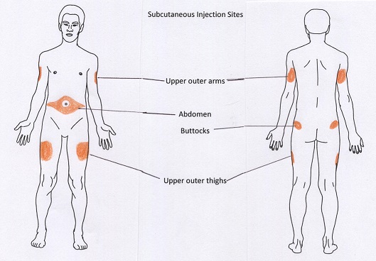 7.4 Subcutaneous Injections \u2013 Clinical Procedures for Safer Patient Care