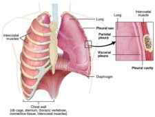 10.6 Chest Tube Drainage Systems – Clinical Procedures for Safer ...