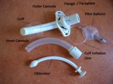 10.5 Tracheostomies – Clinical Procedures for Safer Patient Care