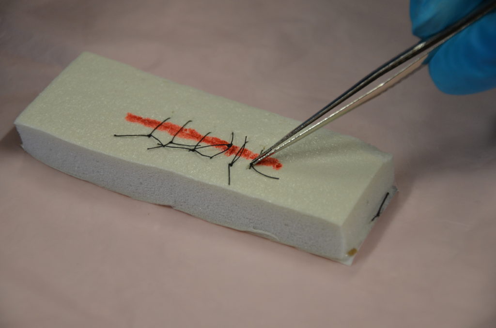Suture Removal Clinical Procedures For Safer Patient Care
