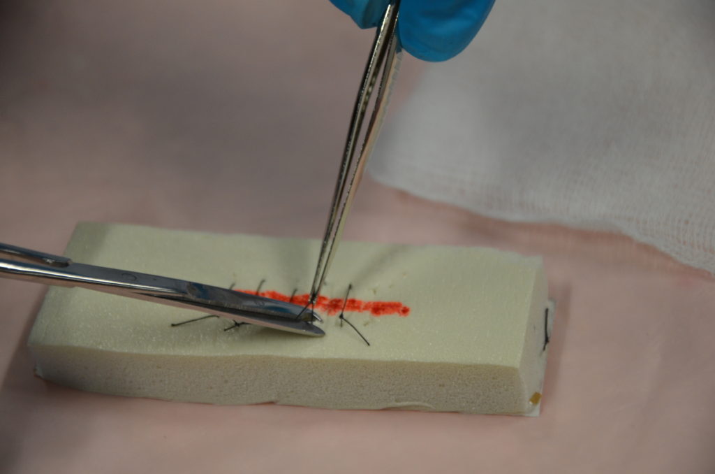 4.7 Suture Removal Clinical Procedures for Safer Patient Care