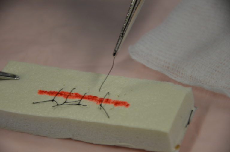 4.7 Suture Removal Clinical Procedures for Safer Patient Care