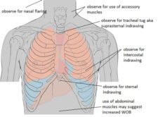 2.7 Head-to-toe Assessment: Chest   Respiratory Assessment – Clinical 