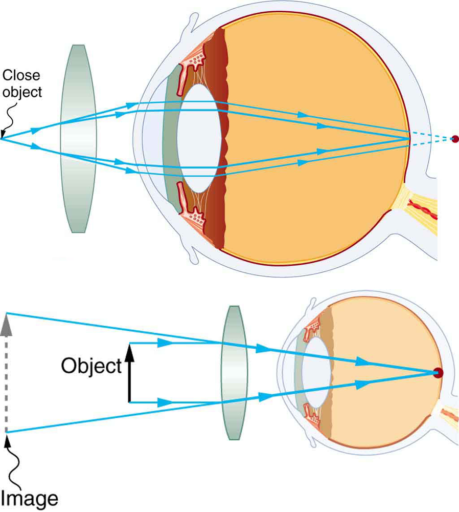 how do contact lenses work physics Shae Longo