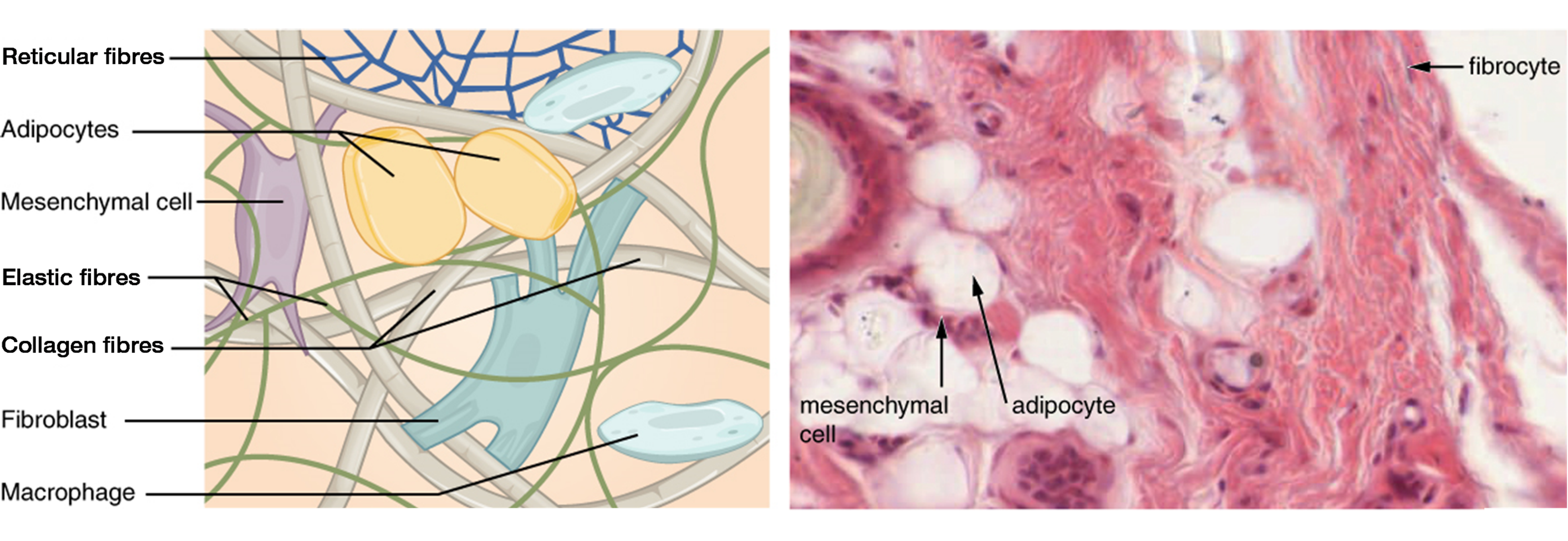 File:DIagram of the different types of soft tissue in the body CRUK 037.svg  - Wikimedia Commons