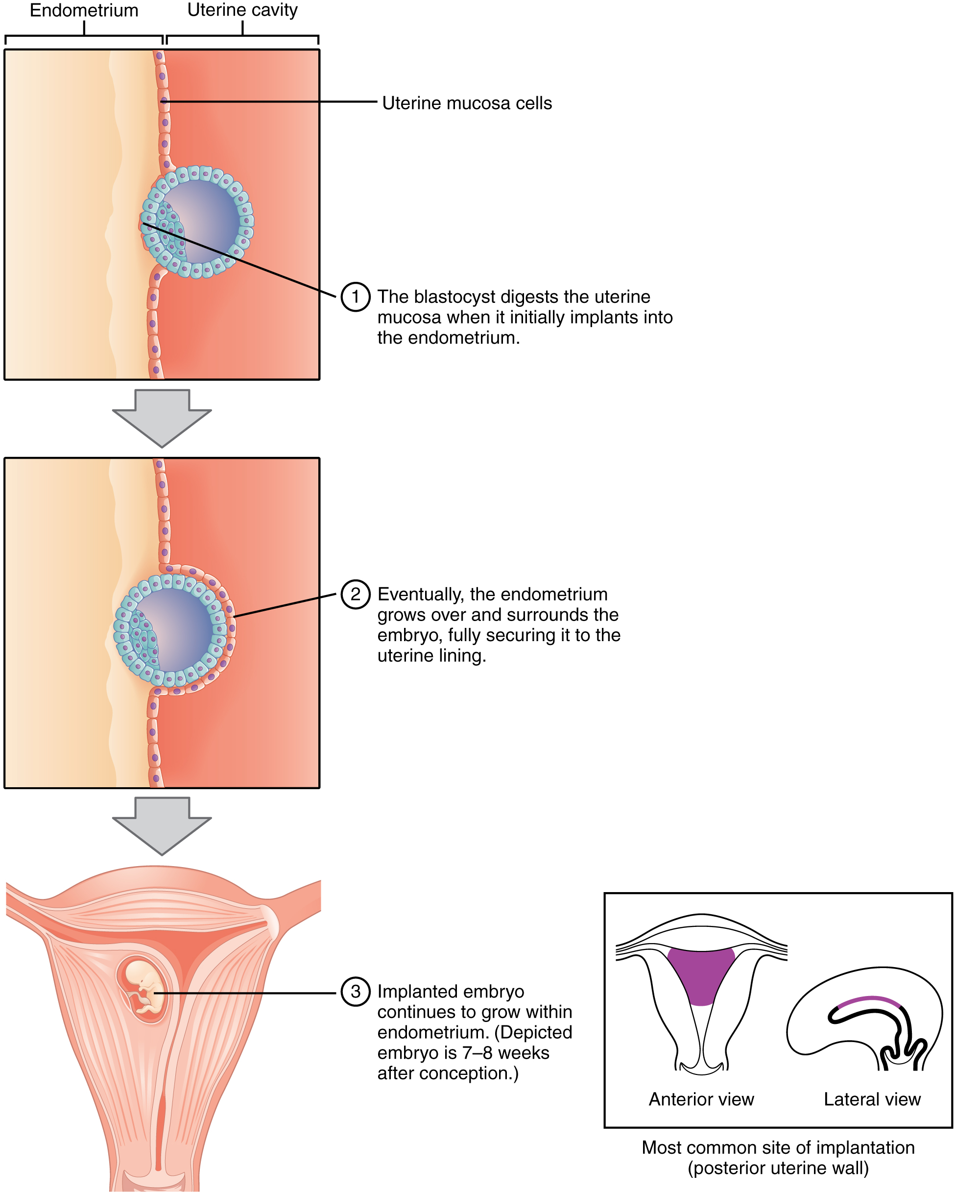 This figure shows the different steps during implantation. The top panel shows how the blastocyst burrows into the endometrium. The middle panel shows the blastocyst completely surrounded by the endometrium. The bottom panel shows the implanted embryo growing in the uterus.