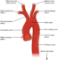 Unit 2: The Cardiovascular System – Douglas College Human Anatomy ...