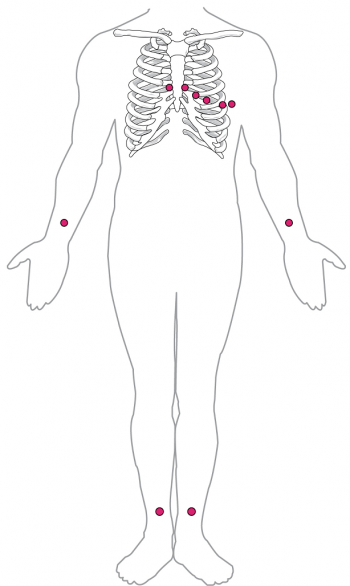 Unit 2: The Heart – Douglas College Human Anatomy & Physiology II (4th ed.)