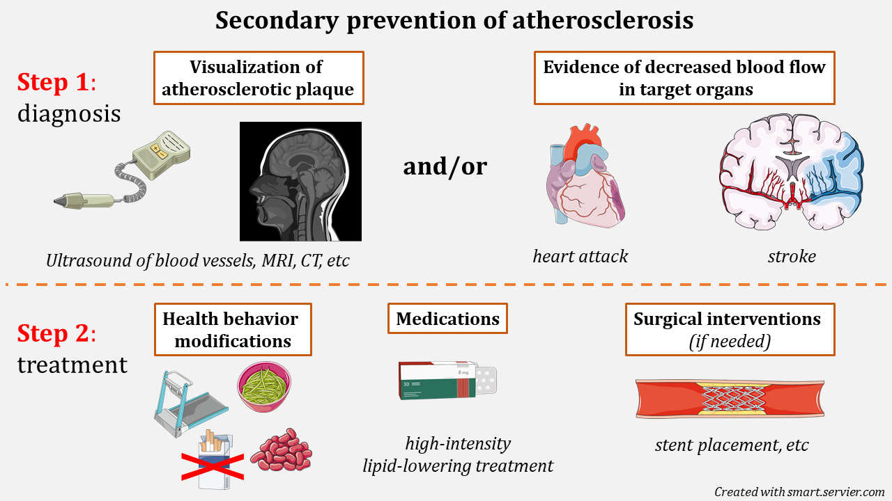 secondary prevention of disease is subdivided into two steps. The first step involves diagnosis which can be visualized (picture of a handheld vascular doppler which is an ultrasound for blood vessel flow and an MRI of a side profile of a head) as evidence of decreased blood flow as seen in heart attack and strokes (heart and brain with a dark discolouration suggesting poor blood flow). Step 2 is treatment (of atherosclerosis) which is managed by health behaviour modifications (image of a treadmill to represent exercise, health food like beans and noodles, and a no smoking sign), medications (image of generic package of pills), and surgical interventions (image of a cross-hatched metal stent inside a arterial vessel and the stent is keeping the walls open)