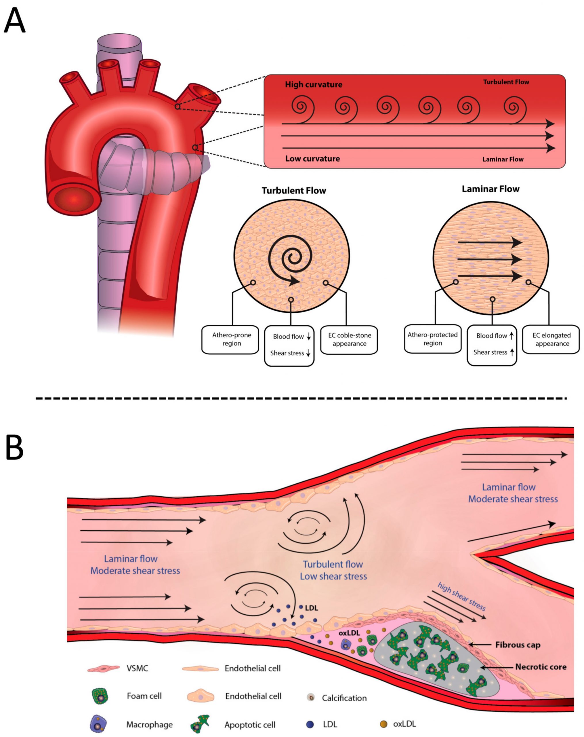image of aorta experiencing normal laminar flow vs turbulent flow. Turbulent flow starts the process of atherosclerotic plaque formation