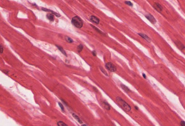 This image is a micrograph of cardiac muscle cells.