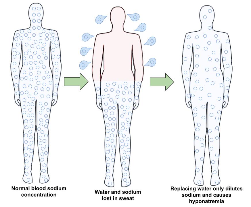 Hyponatremia in the human body