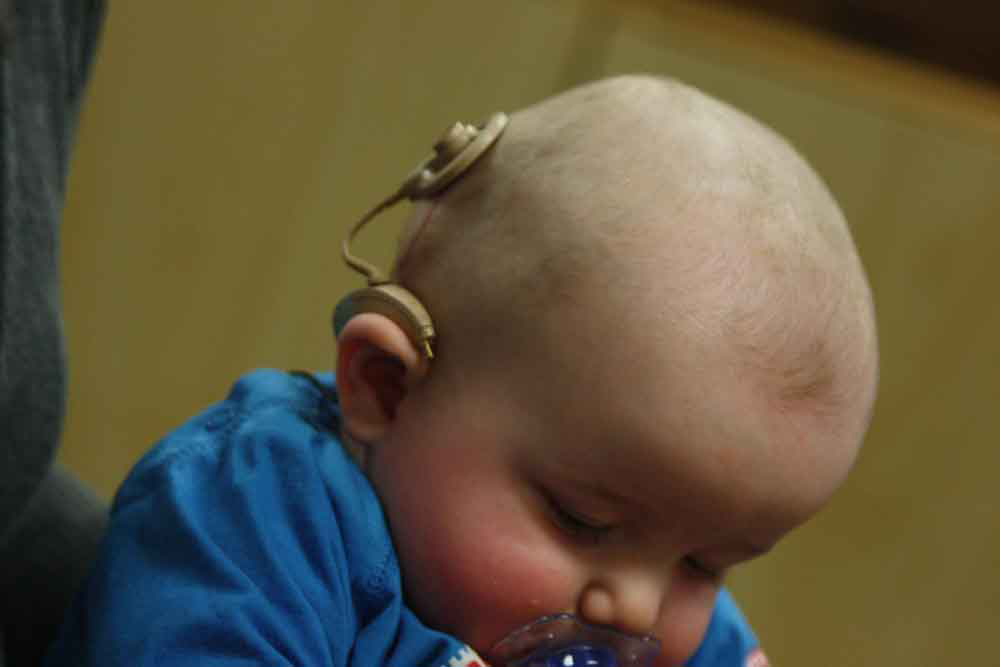 Photograph of a baby with a device attached on its lower part of the head, just above the right ear.