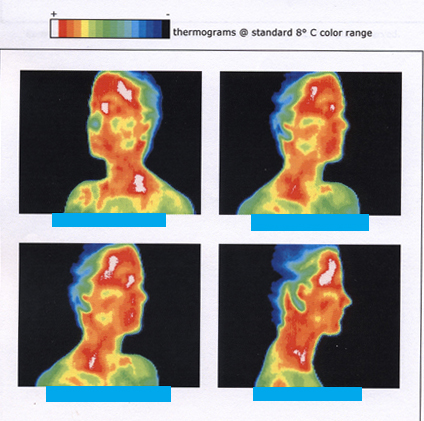 12 1 Temperature And Temperature Scales Douglas College Physics 1207