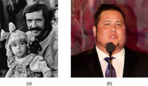 On the left, this picture shows Chastity Bono as a young girl with her father Sonny Bono; on the right, this picture shows Chaz Bono as an adult male.