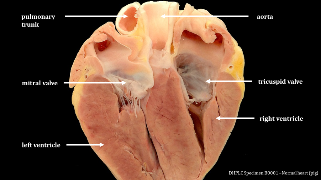 A pig heart has been opened so that the inner chambers are visible. The left ventricle is on the bottom left with a very thick (2-3cm) wall whereas the right ventricle (bottom right corner) has a thinner wall The ventricles are separated by thin white translucent tissue that make up the mitral and tricuspid valves. Thin white strands of chordae tendinae connect these valves to the papillary muscle nestled in the ventricles. Both the pulmonary trunk and aorta take up the top middle: both are thick white tissue that are thick enough to hold their luminal space open.