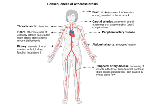 Pathophysiology of Atherosclerosis – Pathology