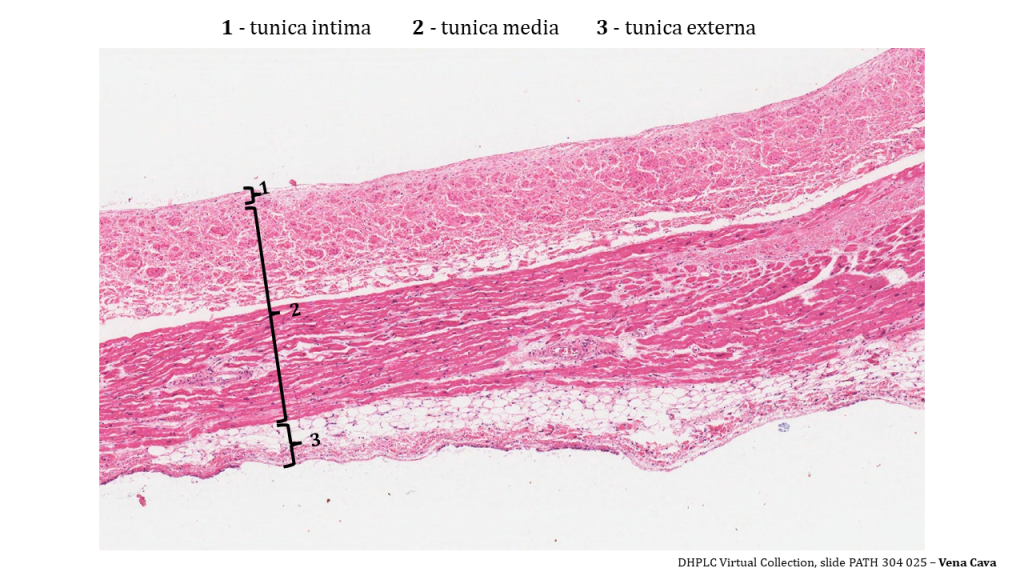 layers of the vena cava is visible and enumerated with 1 (tunica intima) at the top of the image, 2 (tunica media) which fills up the middle of the image), and 3 (tunica externa) which occupies the bottom. All three tunica stain an intense dark pink. The tunica intima and top half of the media are round clusters, arranged in layers. The bottom half of the tunica media shows long dark pink cells with purple nuclei. The externa has a variety of tissues including fat (all white with no stain), and dark pink with purple nuclei.
