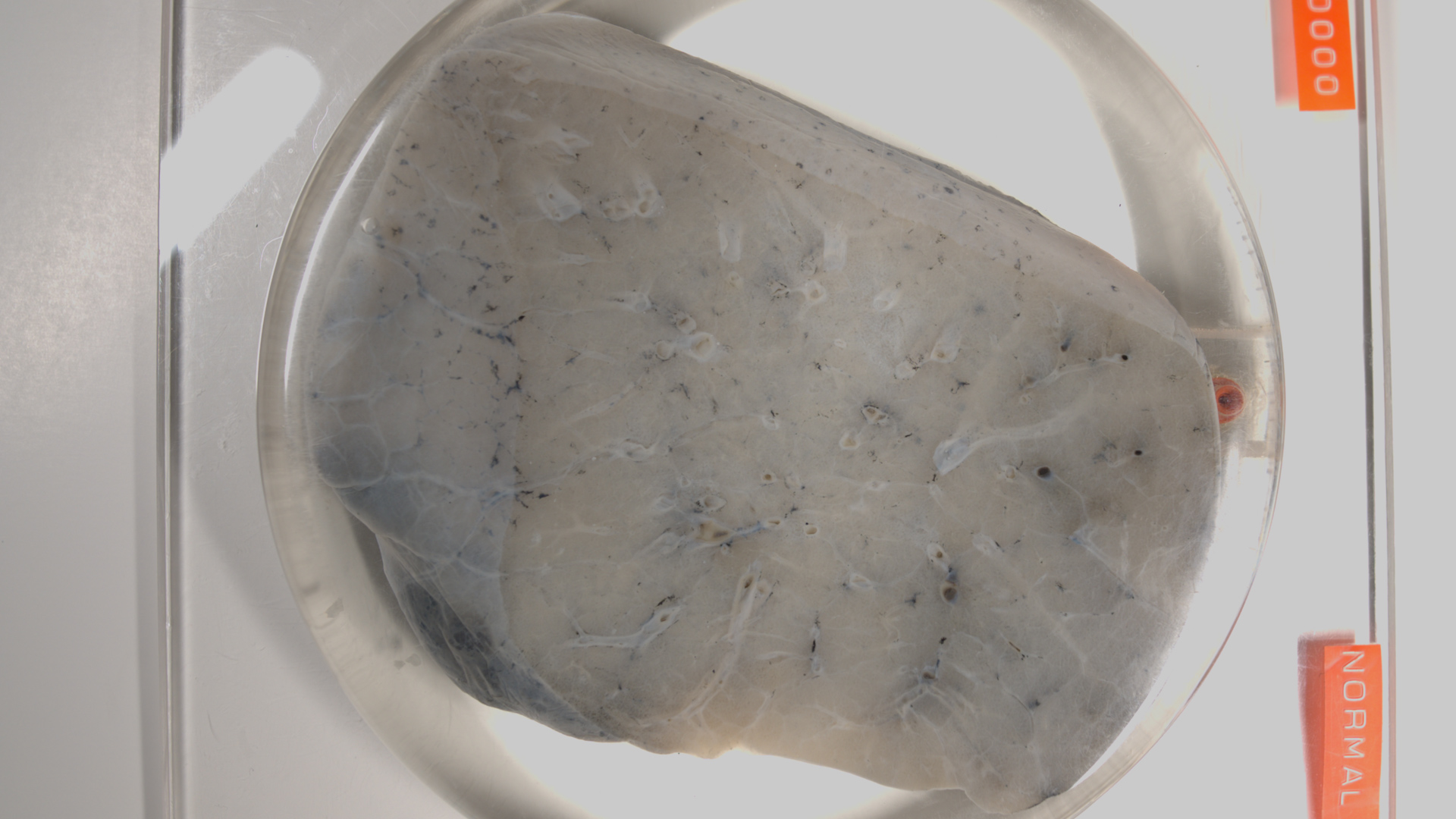 a section of normal lung is mounted. The blood is washed out so that it is a white/light gray in colour with black specks distributed diffusely. It looks like a fine sponge floating in clear liquid.