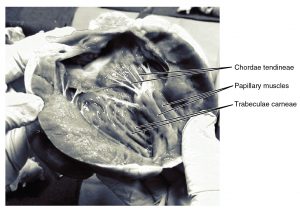 This photo shows the inside of the heart with the main muscles labeled.