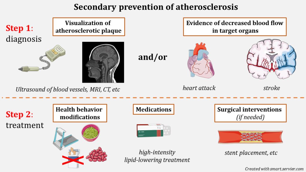 secondary prevention of disease is subdivided into two steps. The first step involves diagnosis which can be visualized (picture of a handheld vascular doppler which is an ultrasound for blood vessel flow and an MRI of a side profile of a head) as evidence of decreased blood flow as seen in heart attack and strokes (heart and brain with a dark discolouration suggesting poor blood flow) Step 2 is treatment (of atherosclerosis) which is managed by health behaviour modifications (image of a treadmill to represent exercise, health food like beans and noodles, and a no smoking sign), medications (image of generic package of pills), and surgical interventions (image of a cross-hatched metal stent inside a arterial vessel and the stent is keeping the walls open)