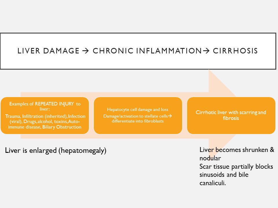 a flow chart which shows how repeated liver damage (list of multiple causes) leads to chronic inflammatory process involving tissue remodeling (stellates differentiate into fibroblasts) leading to the characteristic appearance of cirrhosis: shrunken and scarred liver which affects flow within sinusoids and canaliculi