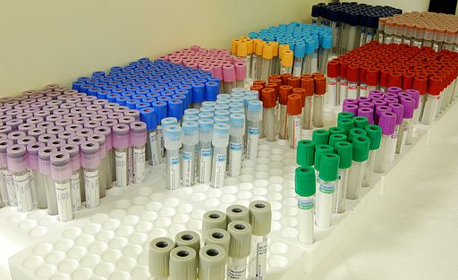 multipe empty blood vials are in racks, grouped by the colours of the tube tops