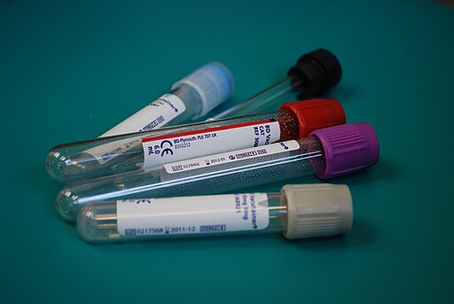 Five empty vials for blood tests are lying down. Each have a different coloured top: gold, purple, red, black, and blue