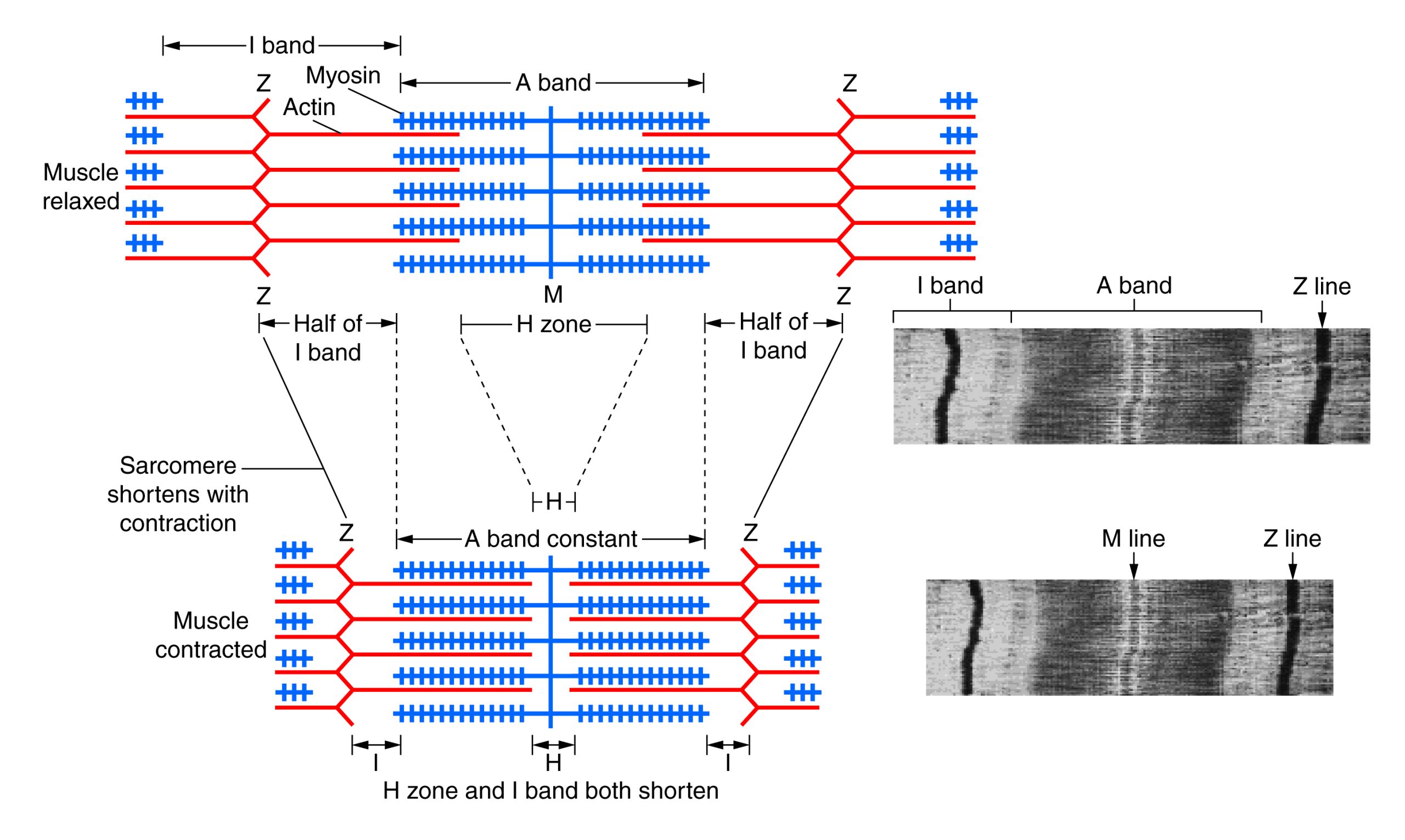 This figure demonstrates the striated pattern of myosin and actin molecules within the muscle. Also shown are the different zones of the sarcomere.