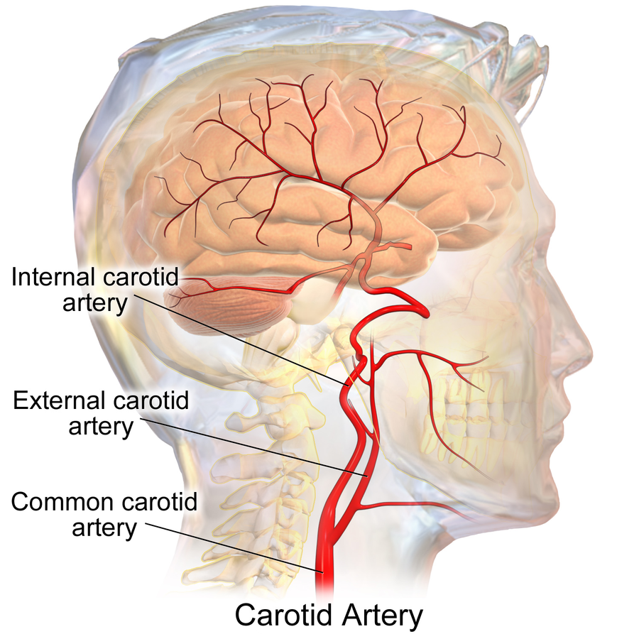 This figure demonstrates the anatomy of the carotid artery, which delivers oxygen rich blood to the brain.