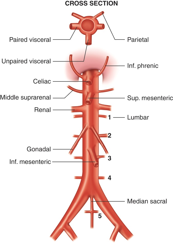 The frontal view of the abdominal aorta with its branches dominate the image. AT the very top of the image, a cross section of the abdominal aorta is visble with the centra lumen space visible with arrows pointing to the visceral and parietal coverings