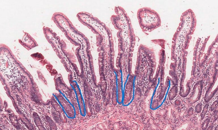 A New Learner’s Guide to Tissue Structures: Glands and Ducts – Pathology