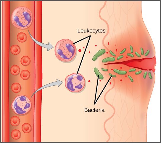 The diagrams shows the migration of leukocytes from the blood vessels to the site of infection where bacteria has infiltrated skin as the first line of defense.