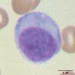 This images shows a lymphocyte stained in Wright dye, with its nuclei appearing dark-purple in high magnification.