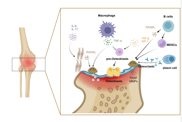 Autoimmune pathway triggering Rheumatoid Arthritis inflammation