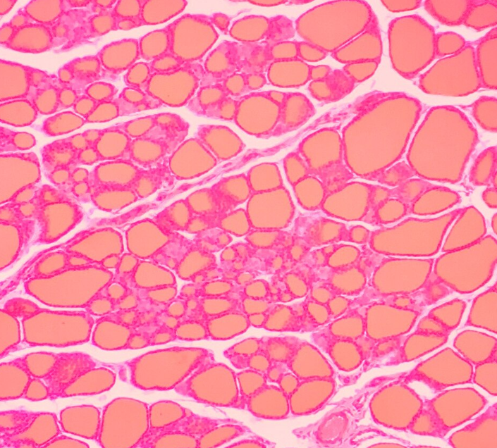 Thyroid follicle section under light microscope