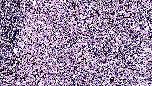 A microscopic section of connective tissue specifically stained to highlight reticular fibers. A delicate, branching network of dark black fibers forms a structural scaffold. Cells, likely lymphocytes or other parenchymal cells, are visible in the background with pale nuclei. Stained with a special silver-based reticulin stain.