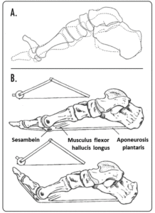 The effect of dorsiflexing the toes on arch height (A). The windlass mechanism (B).